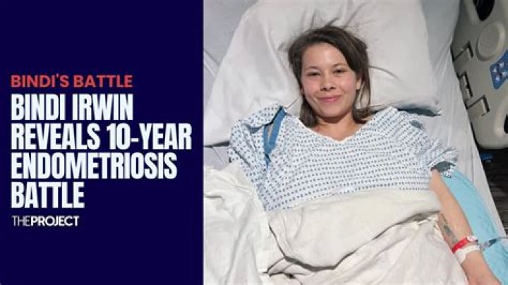Bindi Irwin reveals 10 year endometriosis battle: ‘fatigue, pain and nausea’