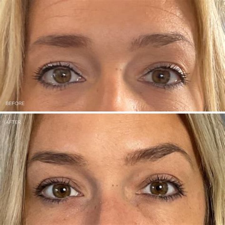 Janice Dickinson has Botox & delusions oozing out of every pore