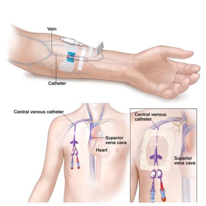 Stassi Schroeder: ‘I definitely get IVs on the reg’ to handle constant hangovers